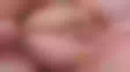 Site thumbnail
