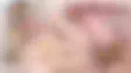 Site thumbnail