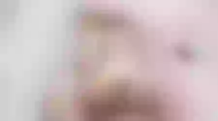 Site thumbnail