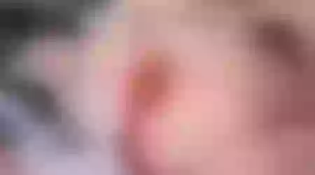 Site thumbnail