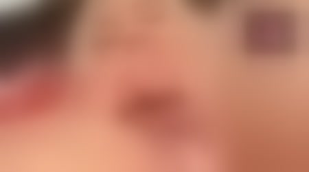 Site thumbnail