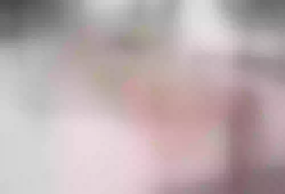 Site thumbnail